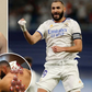 What is 'hijama' and why is Karim Benzema a fan of it?