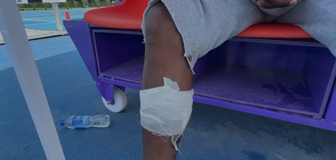 Dennis Mwanzo Attacked by Stray Dog in New Delhi