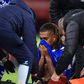 Alex Iwobi suffers a possible season-ending injury in Everton's clash against Manchester United