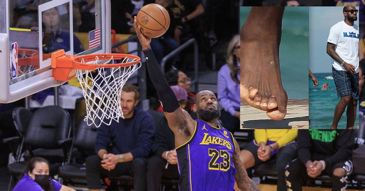 LeBron James’ feet goes viral after shocking picture of his twisted ...