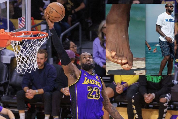LeBron James’ feet goes viral after shocking picture of his twisted toes despite spending Ksh13.6m annually on them