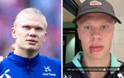 Man City Striker Erling Haaland Picks Up Unexpected Injury Involving a Bus