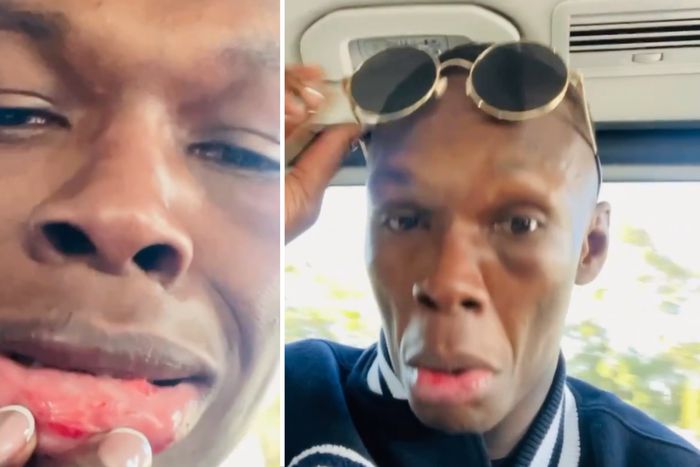 Adesanya then took to social media to show off his black eye - Image Credit - Stylebender/Instagram