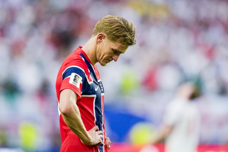 Odegaard looking frustrated || imago