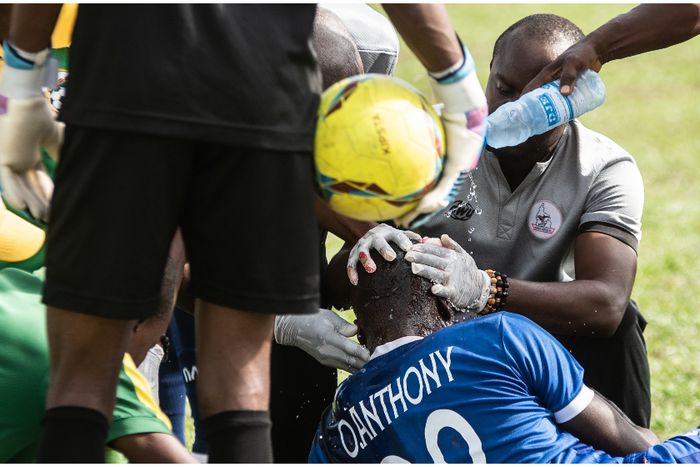 Anthony Ohaegbu of Rivers United suffered a blow against Kwara United in the NPFL.