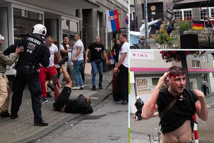 Euro 2024: Bloody scenes in Germany as fans clash before England’s match with Serbia