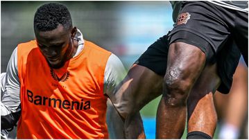 Victor Boniface: Nigeria Super Eagles star reveals shocking surgery scars in latest pictures