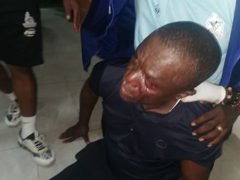 Rivers United General manager Okey Kpalukwu with bloodied face in Kwara.