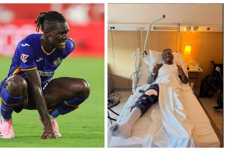 Christantus Uche undergoes knee surgery