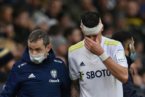 Bielsa defiant over Leeds' treatment of Koch's head injury