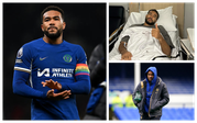 Chelsea defender Reece James in post-surgery struggle with Euro 2024 dream at risk
