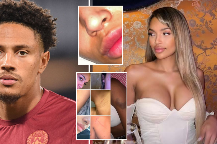 Super Eagles goalkeeper Maduka Okoye has been accused of domestic abuse by his older girlfriend.
