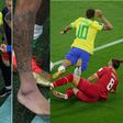 Brazil boss Tite confident Neymar will play despite swollen ankle