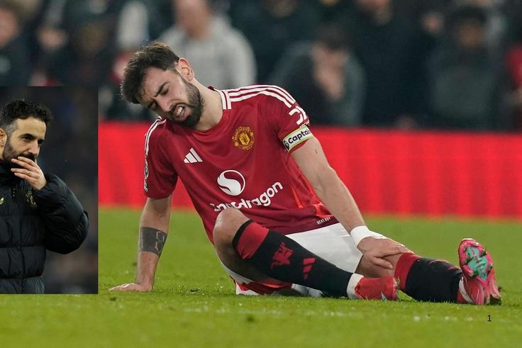 Bruno Fernandes: 7 Ways Manchester United Can Cope Without Injured Playmaker