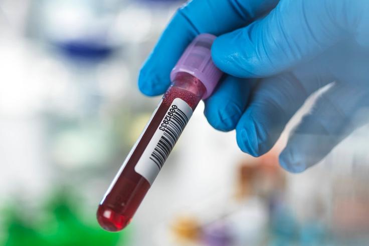 Swiss national jailed in Iten for taking athletes’ blood samples without license