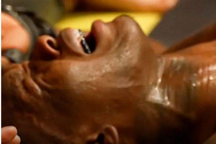 Israel Adesanya tore his MCL during practice the week before the bout