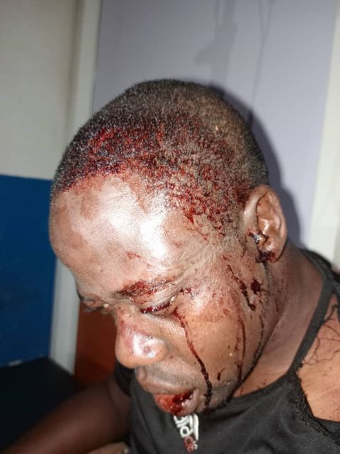 Moses Magogo slams brutal attack on referee by suspected Express fans