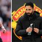 Luke Shaw Reveals Why Ruben Amorim Kicked Out Marcus Rashford, Alejandro Garnacho and Co Out of Man United