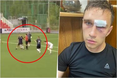 Bývalý kapitán ruských futbalistov zbil počas amatérskeho zápasu rozhodcu