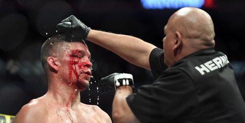 Krvavý súboj bitkárov v UFC ukončil doktor, Diaz po masívnom krvácaní prehral