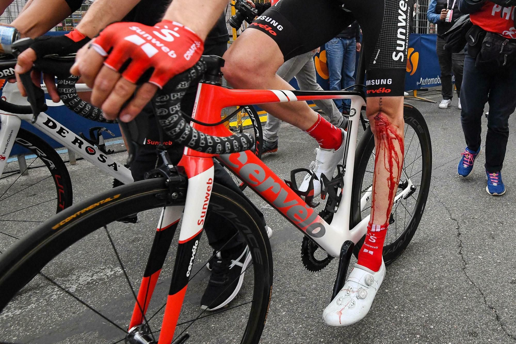 Holandský cyklista Tom Dumoulin má zakrvavenú ľavú nohu po páde v 4. etape cyklistických pretekov Giro d'Italia.