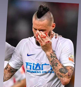 Zakrvavený Marek Hamšík.