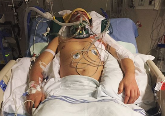 Mark McMorris napojený na prístroje v nemocnici, keď bojoval o život.