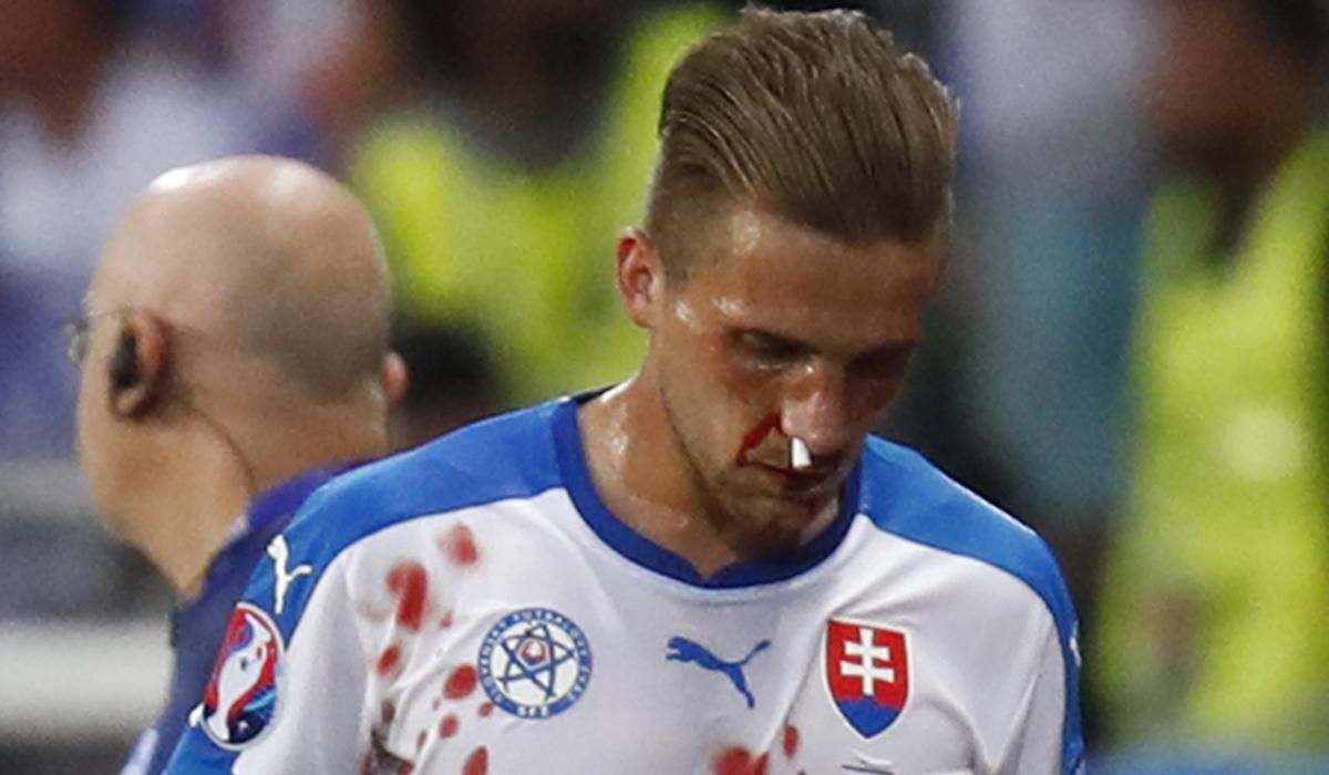 Peter Pekarik, Slovensko, zlomeny nos, EURO 2016, reprezentacia, jun16