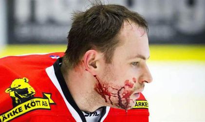 Video: Hrozivý pohľad na J. Hudáčka, spoluhráč mu rozrezal tvár korčuľou