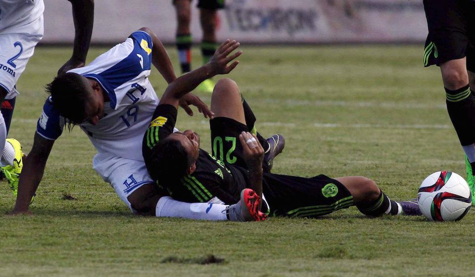 Video: Vo futbale praskali kosti, hráč si brutálne zlomil nohu