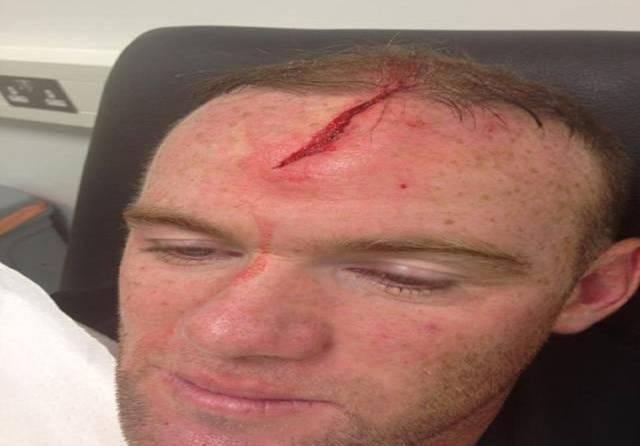 Rooney wayne zranenie sep13 facebook.com