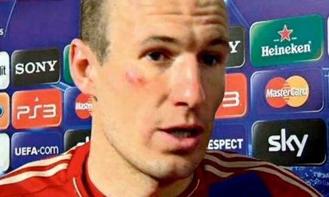 Arjen robben bayern monokel apr2012