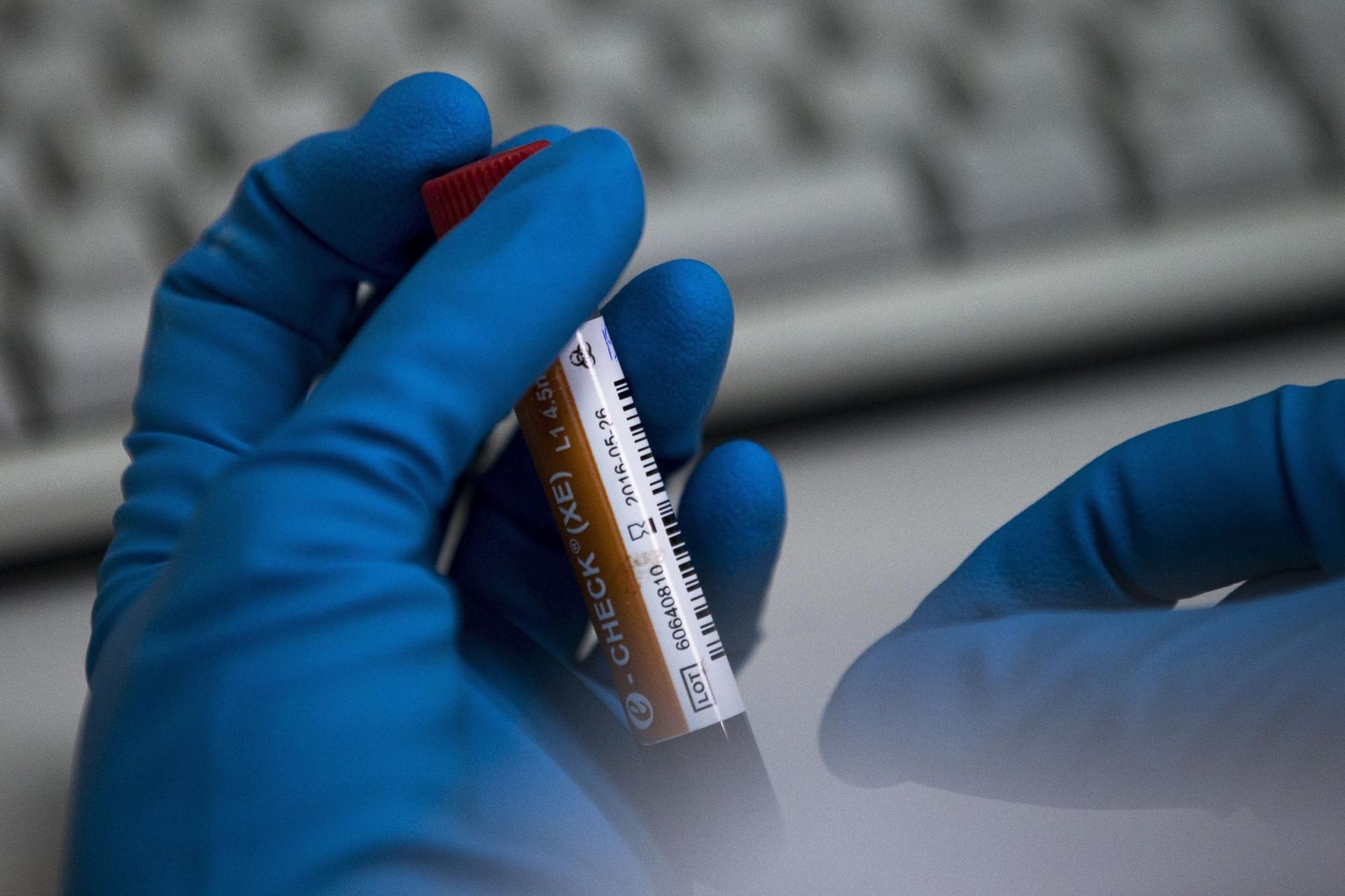 doping Zdroj: SITA/AP