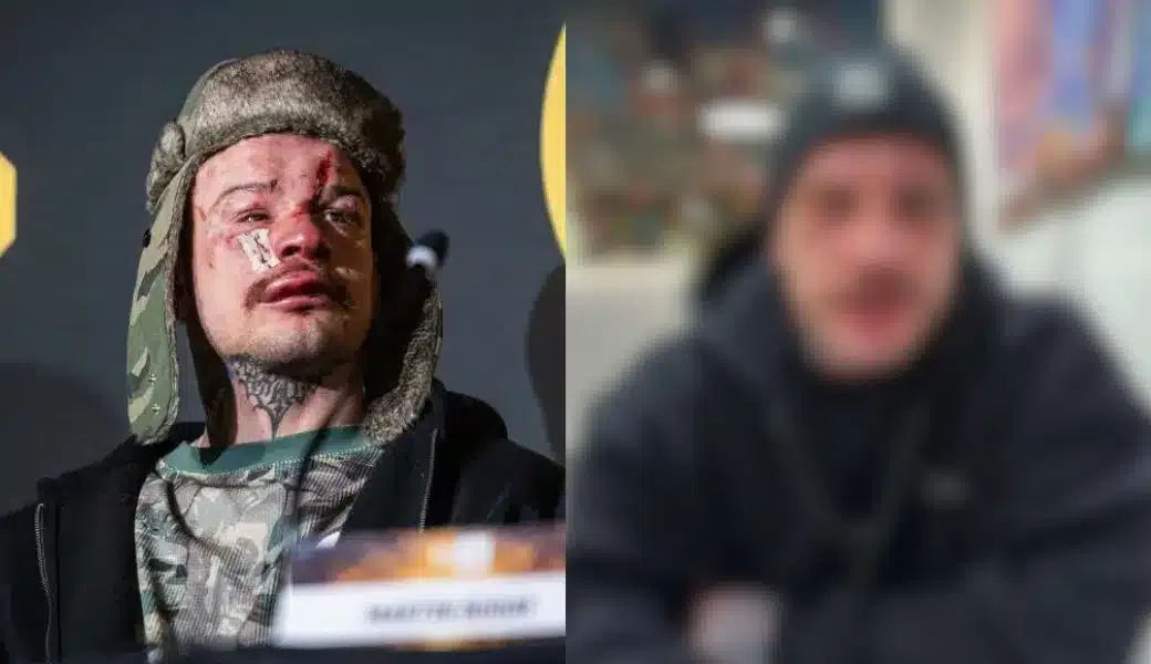 FOTO Uzdravovanie ako Wolverine? Takto vyzerá Robo Pukač 6 dní po zápase s Kinclom