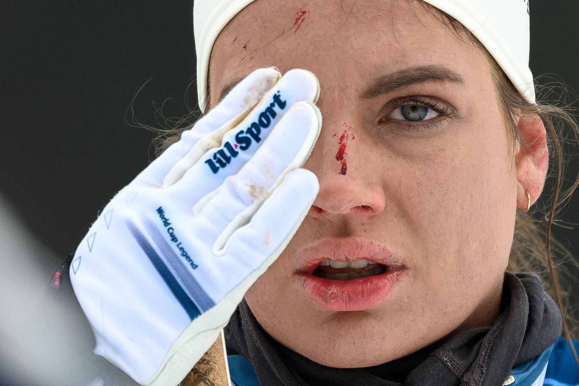 Zranená Kristine Stavaas Skistadová. Zdroj: Imago