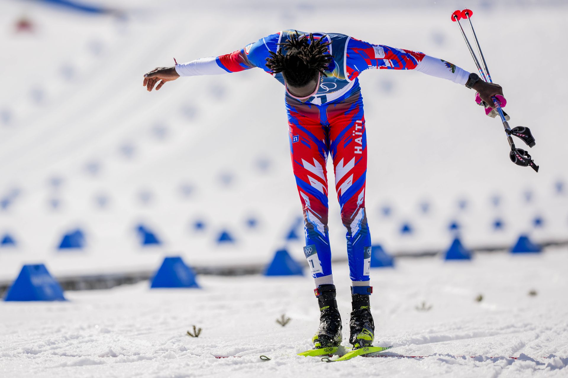 Stevenson Savart. Zdroj: Imago