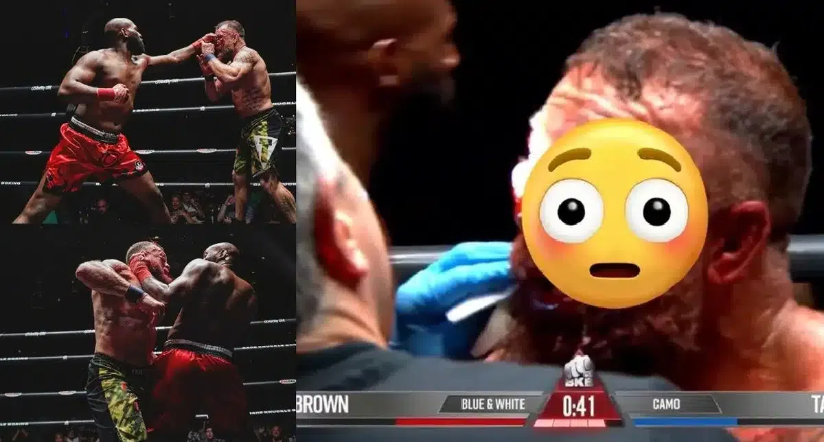 VIDEO Ako z hororu! Bojovník bol po brutálnom priebehu boxu bez rukavíc na nepoznanie. Zápas zastavil doktor