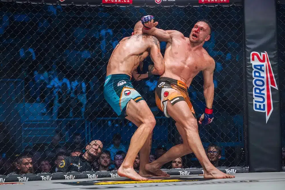 VIDEO Wolverine? Kerim Engizek ukázal v akom stave je jeho zlomenina ruky. Čo si myslí doktor?