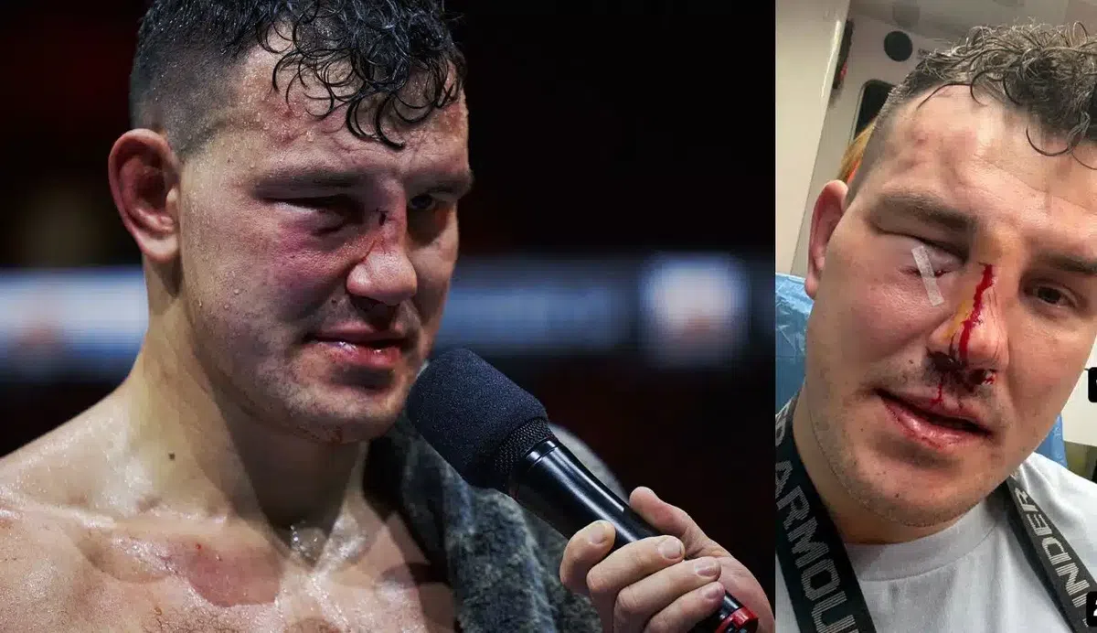 Za 2 minúty viac zlomenín ako za 20-ročnú kariéru? Tomáš Možný si z RFA 26 odnáša tieto zranenia