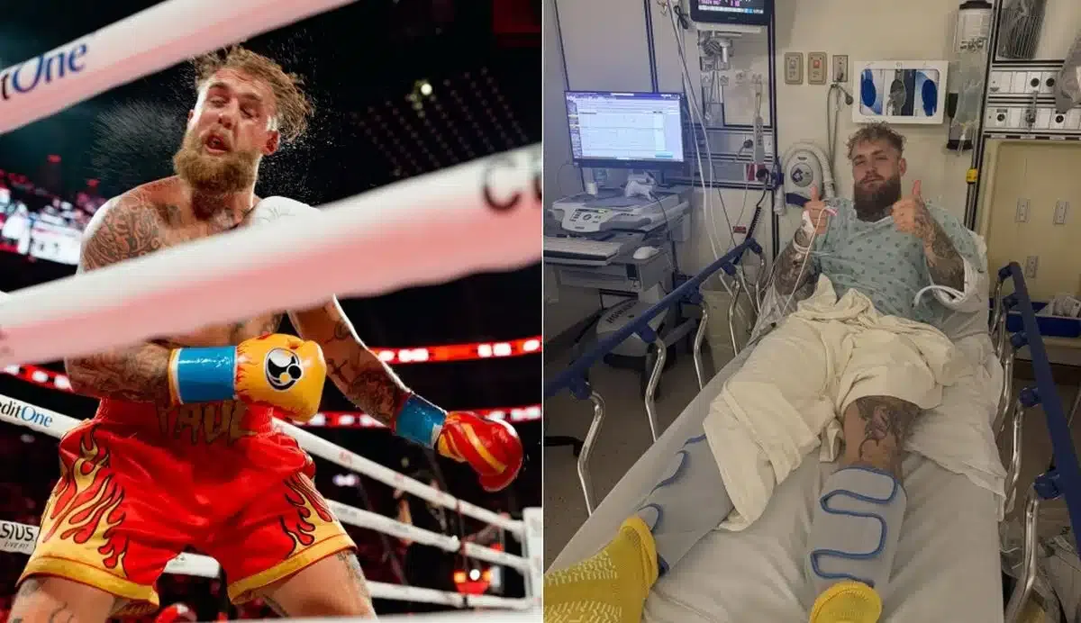 Titánové platničky a strata zubov! Jake Paul uverejnil prvý príspevok po operácii zlomenej sánky zo zápasu s Joshuom