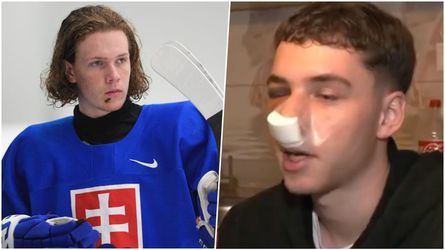 Slovenský hokejový reprezentant zbil mladíka, museli ho operovať! On sa vraj necíti vinný