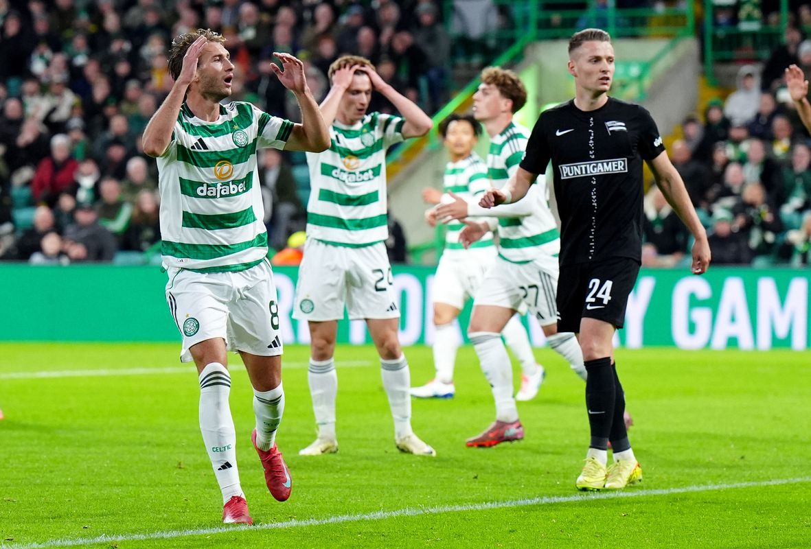 Dočasný tréner stále nevie, čo bude o týždeň. Celtic naďalej hľadá nového muža