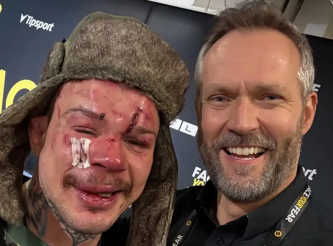 Takmer sa po zápase nespoznal. Robo Pukač vysvetlil, prečo aj napriek prehre je na seba hrdý. Toto si zo zápasu zobral