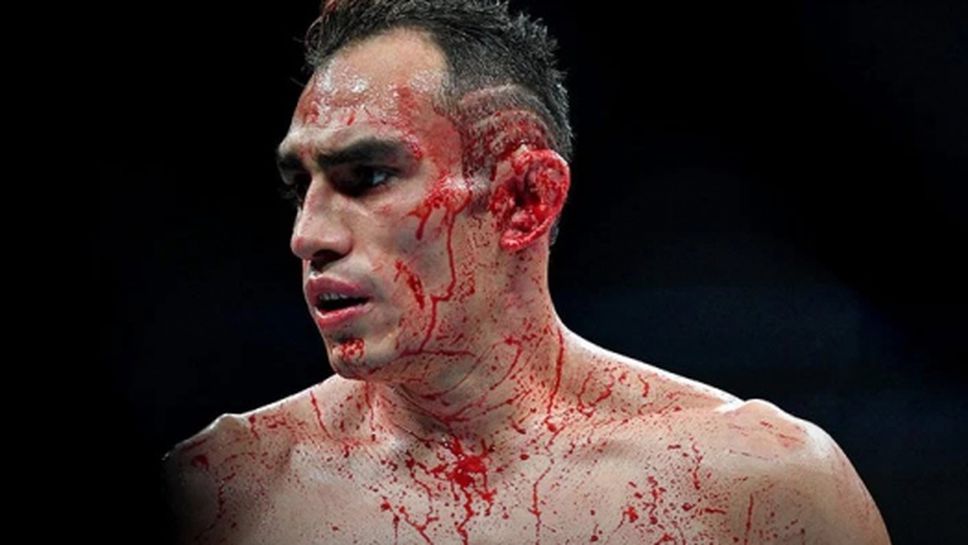 Тони Фъргюсън преби жена си и бе арестуван