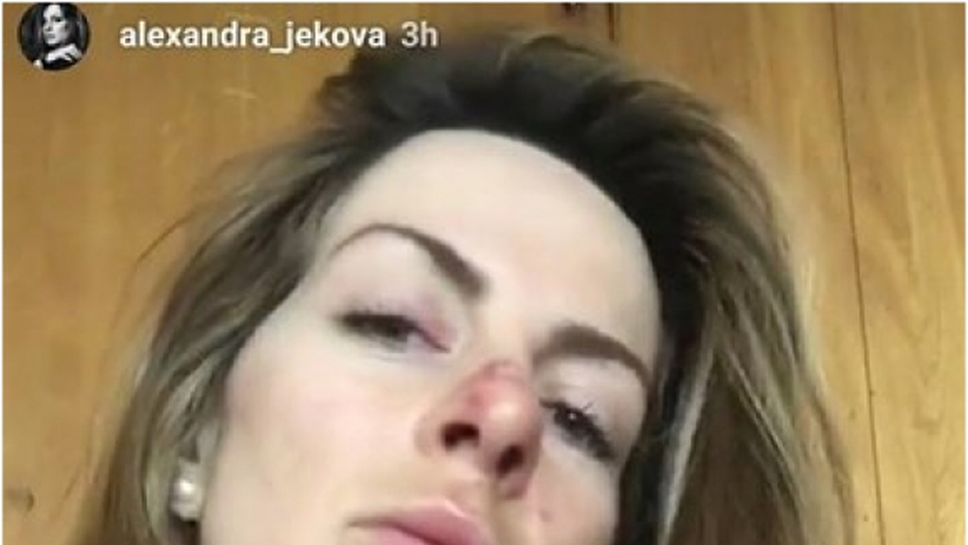 Сани Жекова с извадено рамо и ожулено лице (видео)