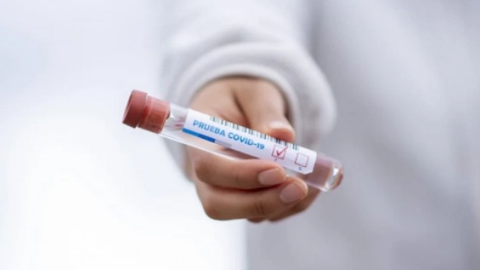 180 нови случаи на COVID-19 у нас