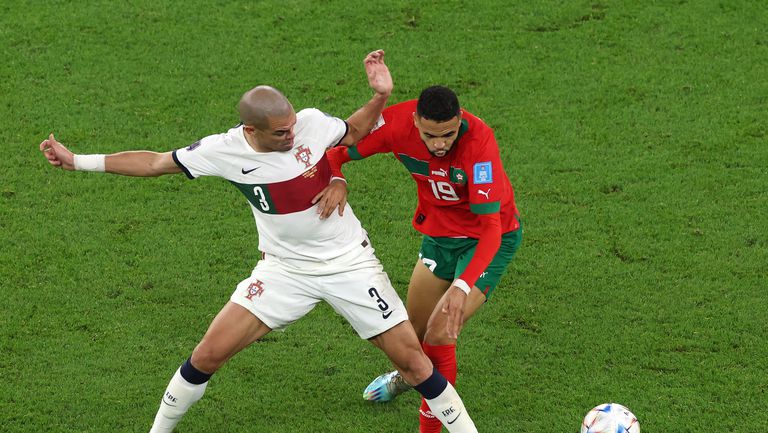 Доказаният боец Пепе е изтърпял да играе със счупена ръка