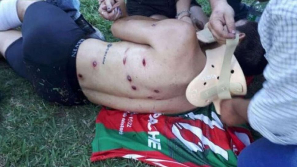 Невиждан терор: полицаи надупчиха футболист с 13 куршума по време на мач (видео+снимки)