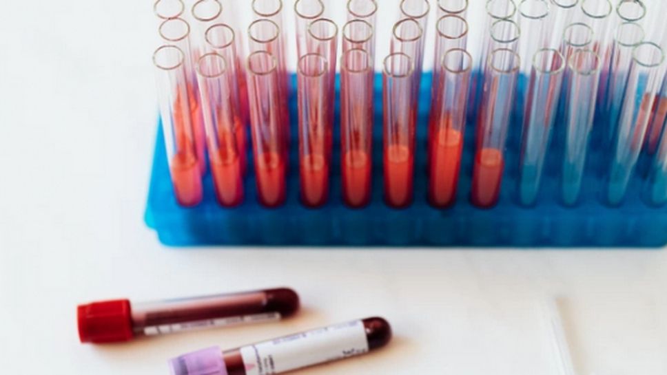 174 са новите заразени с коронавирус у нас, има още 8 жертви