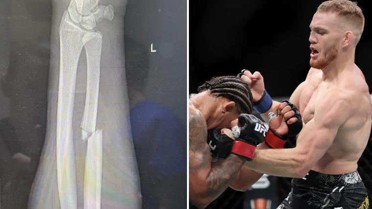 Мадалена получил тежка контузия още в началото на битката с Дуриньо